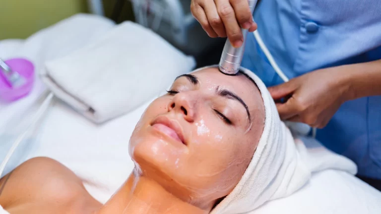 Chemical Peels Treatment in Hyderabad