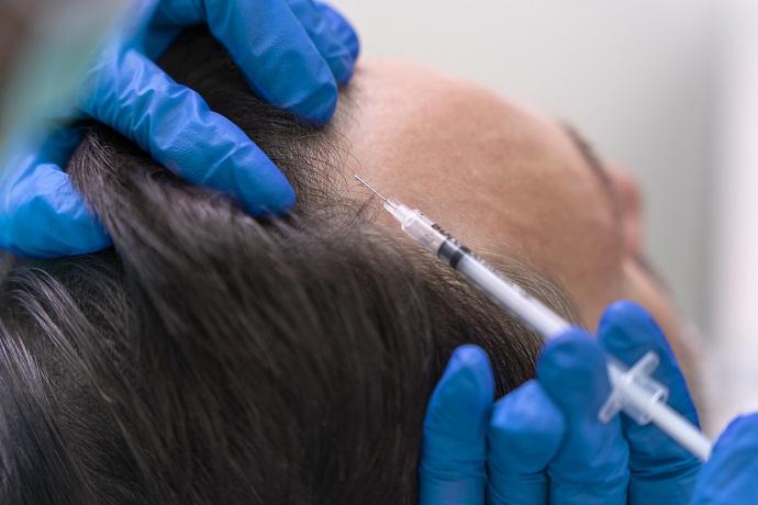 GFC Treatment