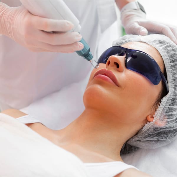 laser skin treatment