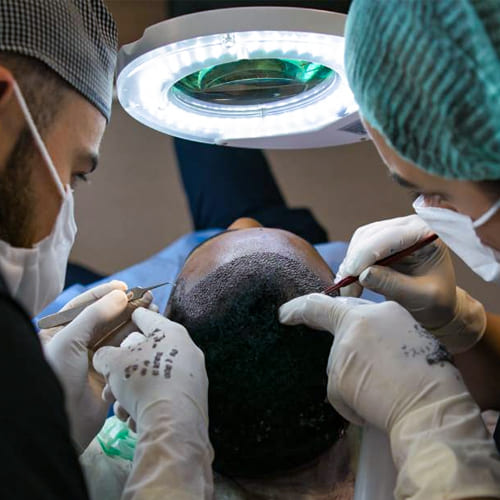 Choosing the Right Hair Transplant Procedure: A Comprehensive Guide
