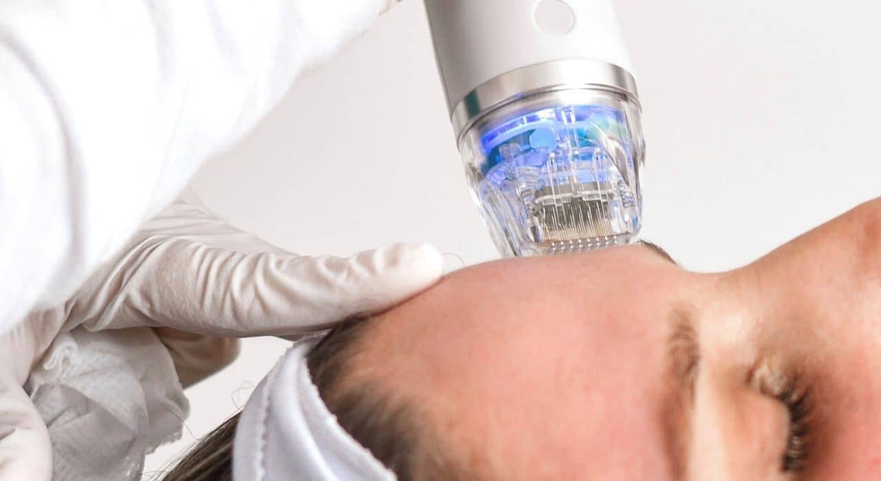 Unveiling the Marvels of Microneedling and MNRF: A Comprehensive Guide