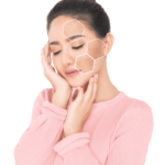 Best Pigmentation Treatments