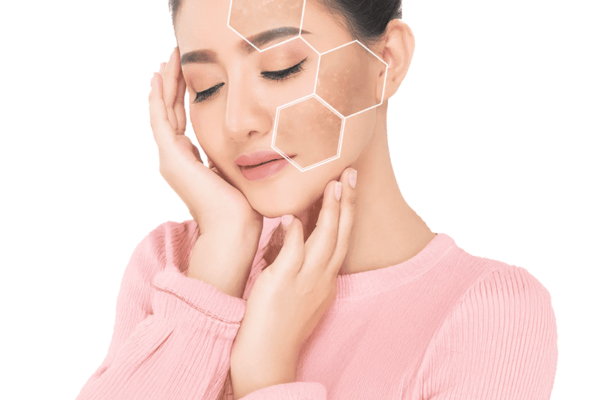 Choosing the Best Pigmentation Treatments for Healthy & Glowing Skin