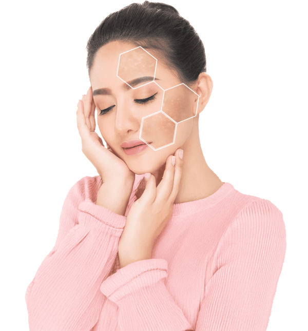Choosing the Best Pigmentation Treatments for Healthy & Glowing Skin
