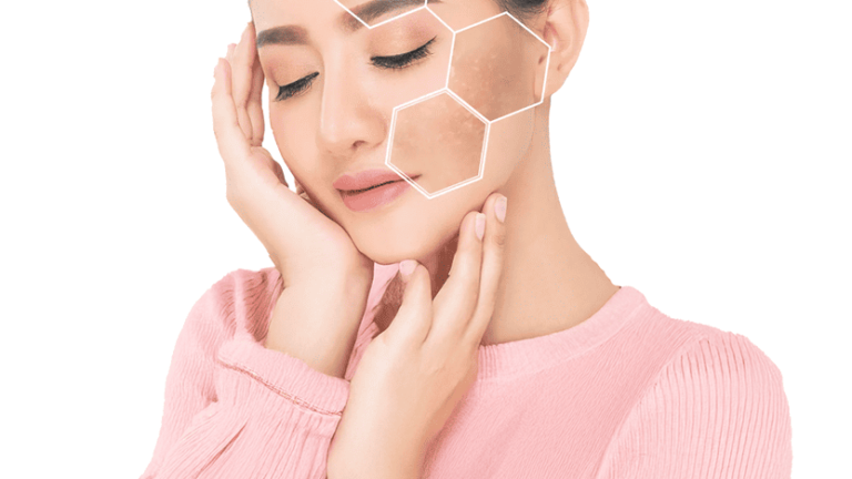 Best Pigmentation Treatments
