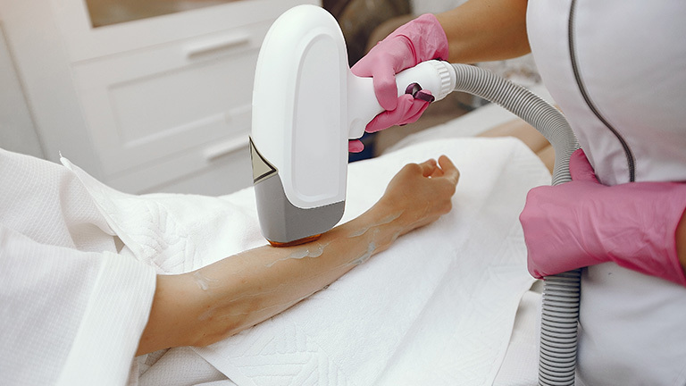advancements in laser hair removal