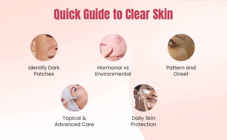 Difference Between Melasma and Pigmentation