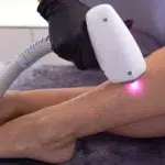 LHR TREATMENT