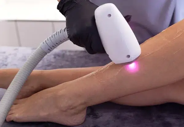 Is Laser Hair Removal Right for Indian Skin? A Dermatologist Explains