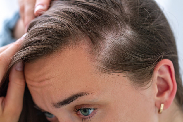 Hair Loss Treatments