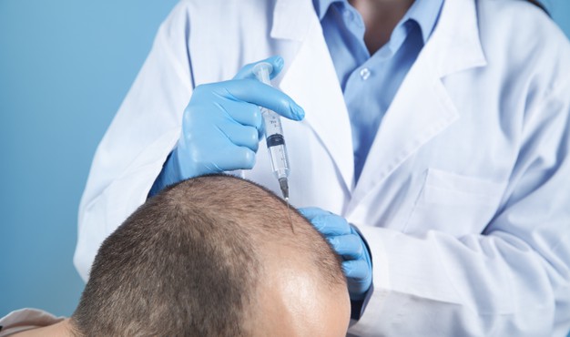 FUT Hair Transplantation in Hyderabad