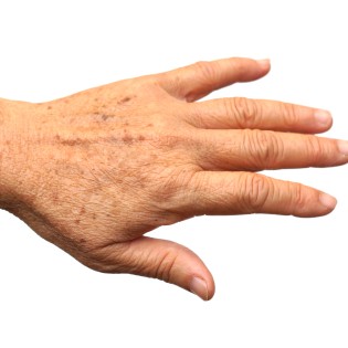 Aging Hands