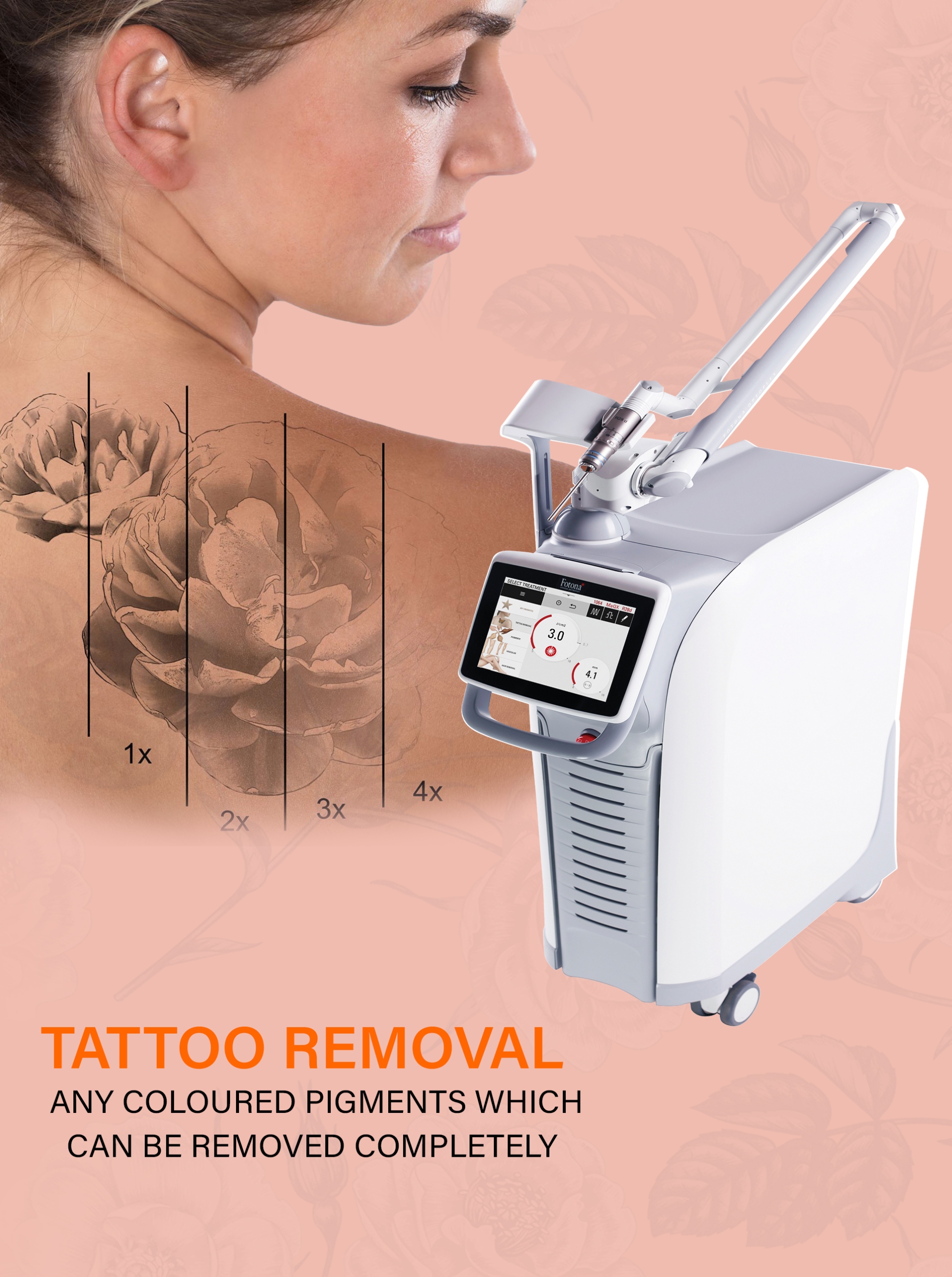 Tattoo Removal