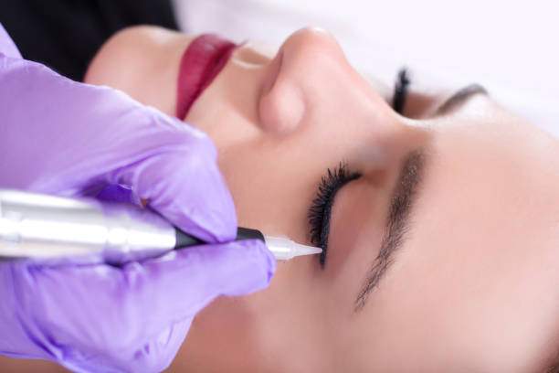 Permanent Eyeliner Treatment In Hyderabad