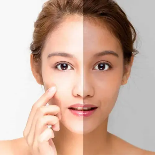 skin whitening