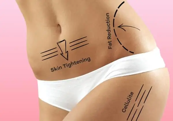 Skin Tightening Treatment Procedures