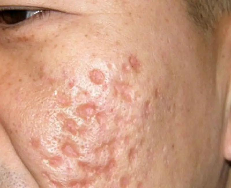 Box Scars at FMS SKIN