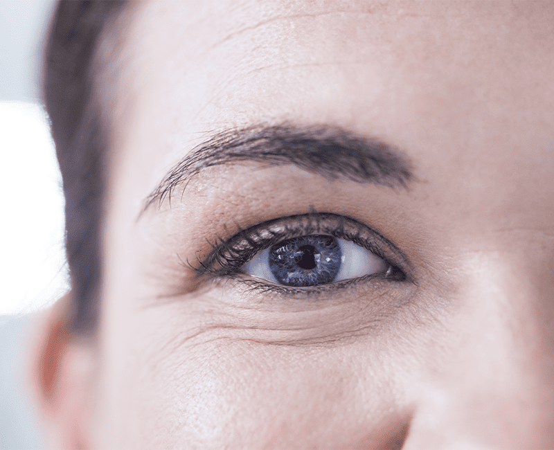 Eye Wrinkles