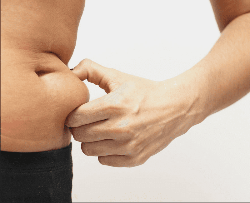 Stubborn Fat Treatment