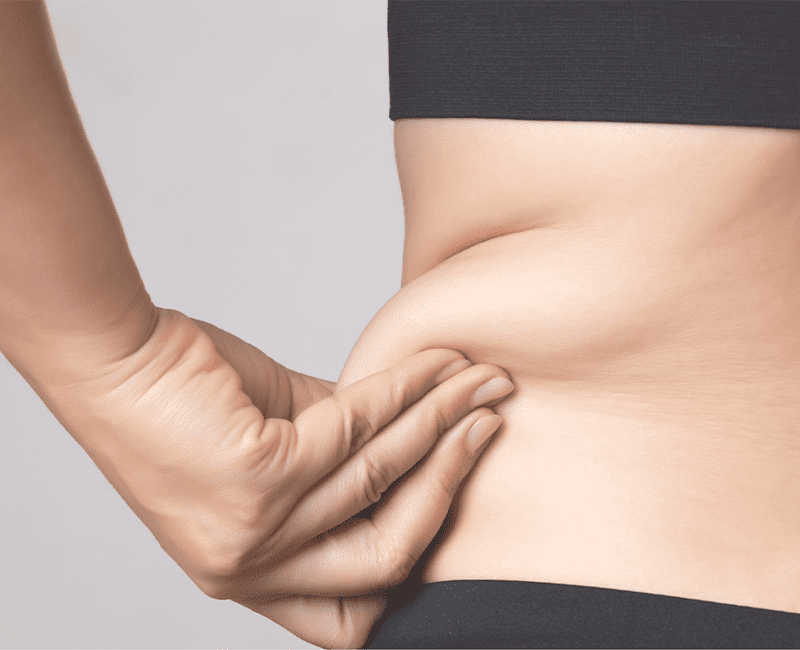 Stubborn Fat