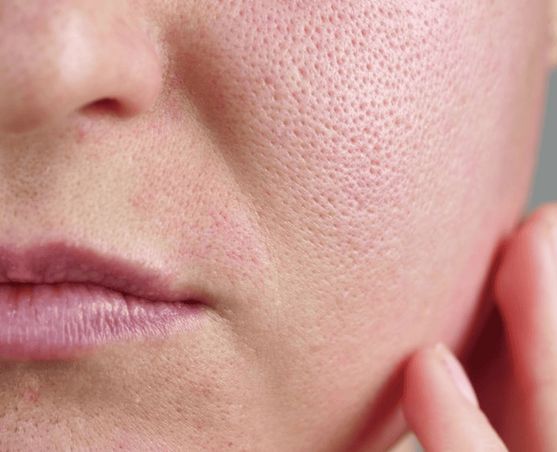 Face Skin Texture Png