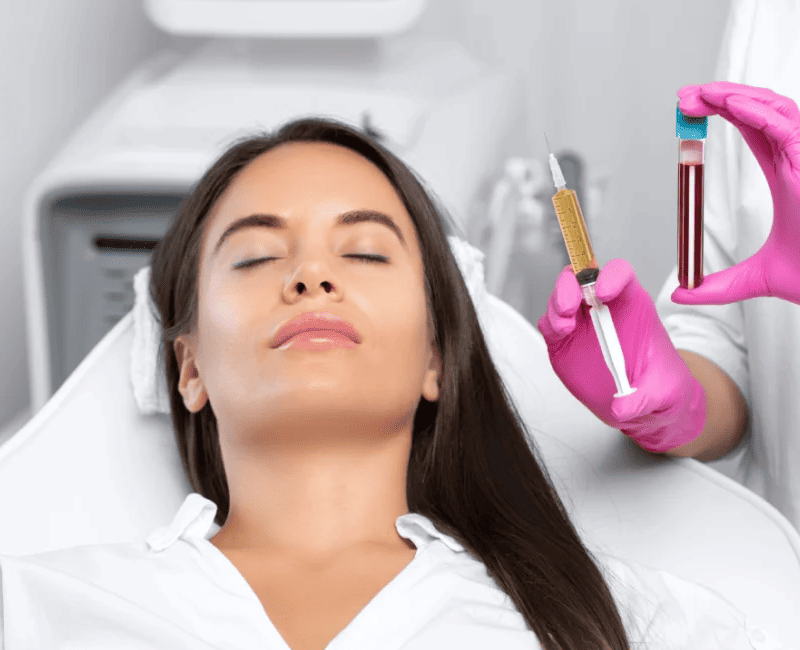 PRP Facial Rejuvenation