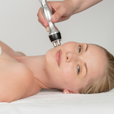 Radiofrequency (RF) Skin Tightening