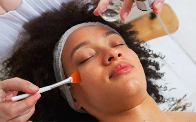 Chemical Peels for Sun Tan Treatment