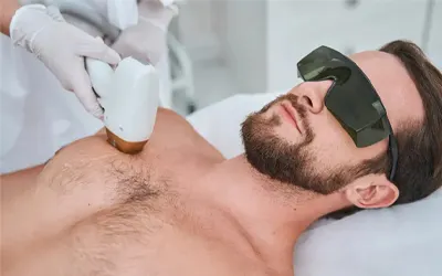 Chest and abdomen laser hair removal