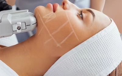 Complete Chin Sculpt Protocol Treatment