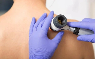 skin cancer screening and dermatoscopy