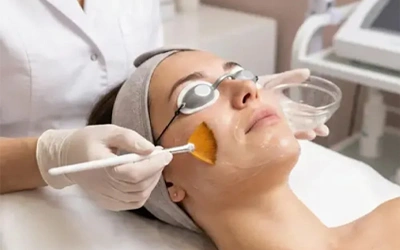 FMS Signature Peel Protocol for PIH