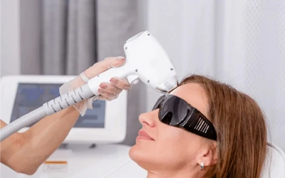 Forehead and hairline laser treatment