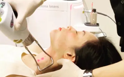 Fotona TightSculpting Treatment