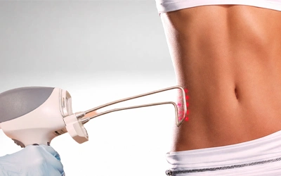 Fotona TightSculpting laser body treatment