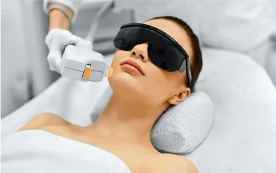 Full face laser hair removal treatment