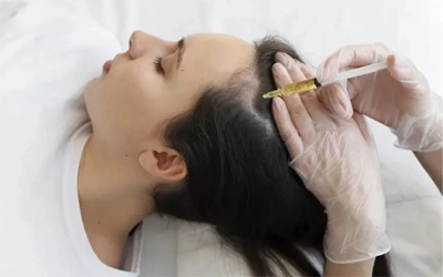 GFC Therapy for PCOS Hair Loss