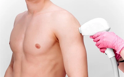 Shoulder laser hair removal