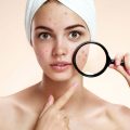 acne-treatment Best Acne Treatment
