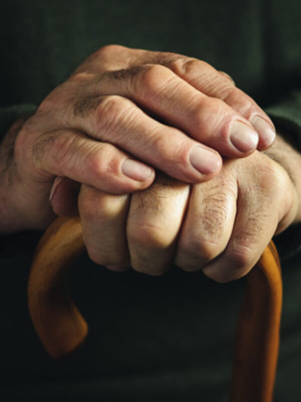 Treatments for Aging Hands